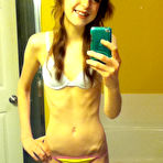 Pic of Anorexic Selfies (10 pics)