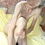 Pic of Granny nudistoma