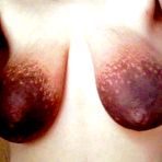 Pic of Real Huge Nipples